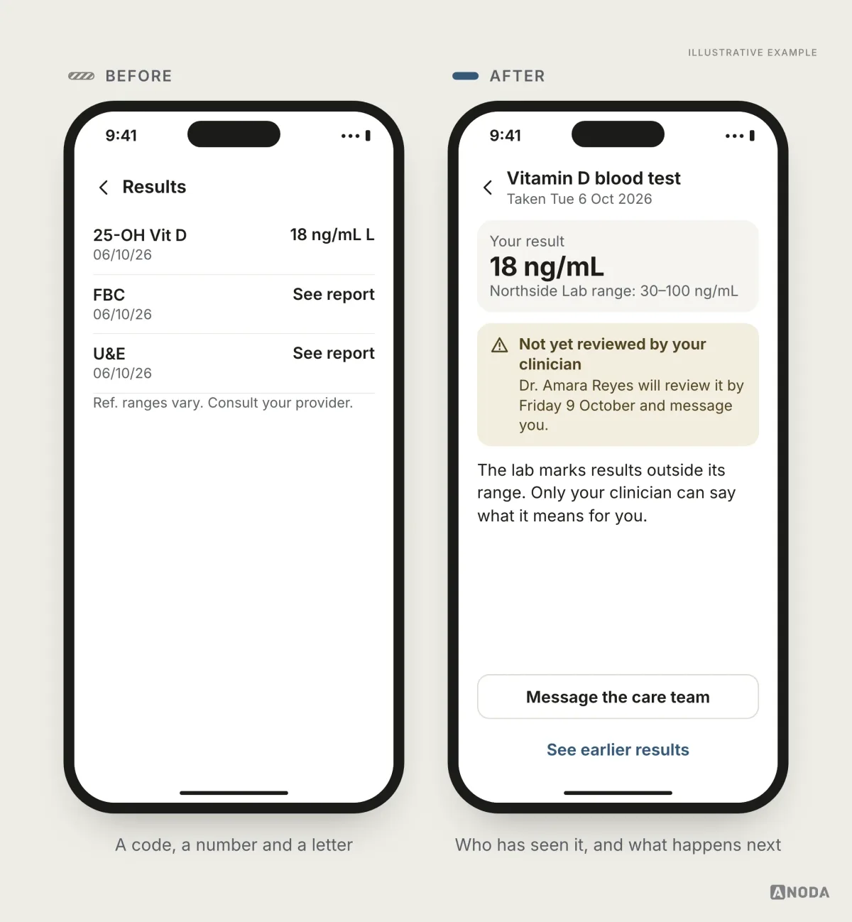 Before and after, illustrative example: on the left a results list showing “25-OH Vit D 18 ng/mL L” and two more coded tests with a small “Ref. ranges vary” note; on the right the same result named “Vitamin D blood test” with the value against “Northside Lab range: 30–100 ng/mL”, a note “Not yet reviewed by your clinician”, “Dr. Amara Reyes will review it by Friday 9 October”, and actions to message the care team or see earlier results.